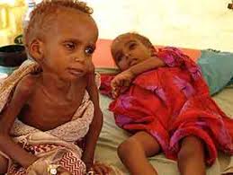enfants somaliens qui meurent de faim