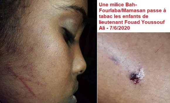 Djibouti/Lt Fouad : Une milice Bah-Fourlaba/Mamasan cagoulée a passé à tabac les enfants de lieutenant Fouad Youssouf Ali.